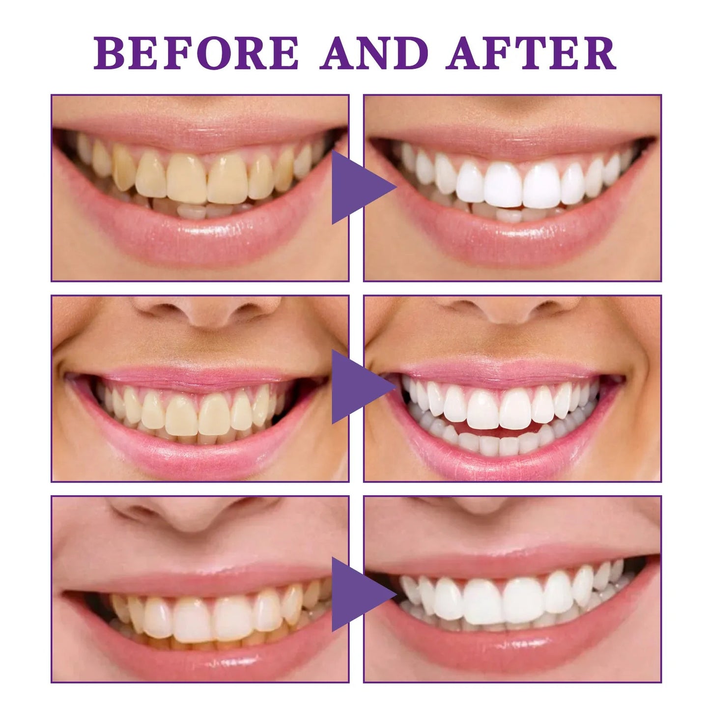 V34 Tooth Cleaning Mousse - BH Comfy Cozy