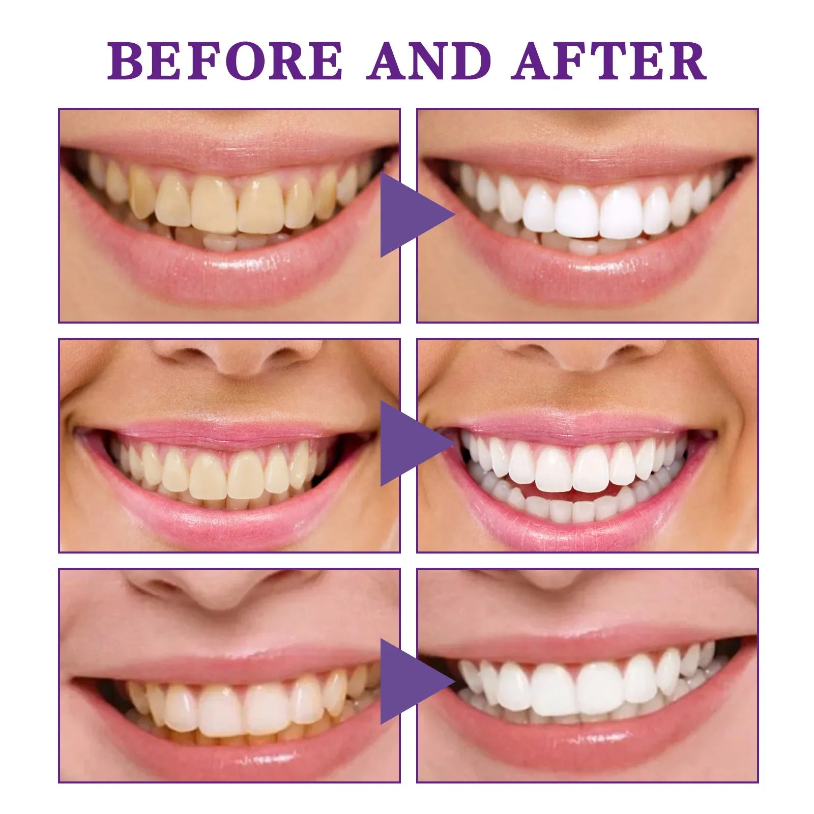 V34 Tooth Cleaning Mousse - BH Comfy Cozy